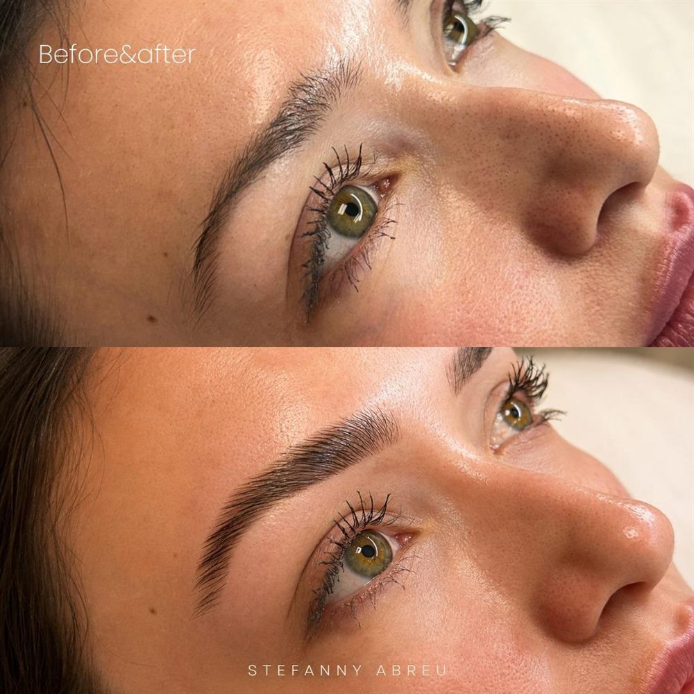 Brow transformation before and after