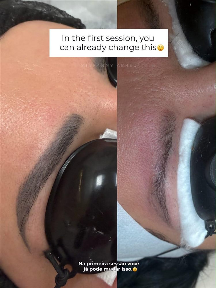 Brow transformation before and after