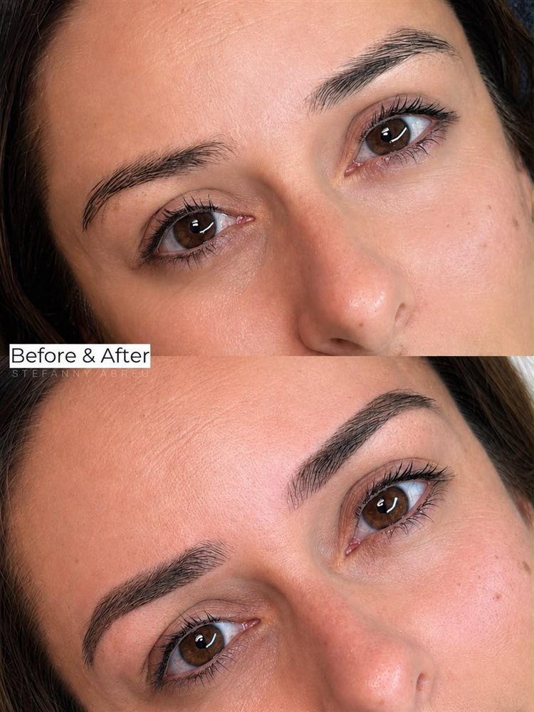 Brow transformation before and after