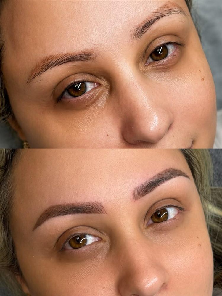 Full brow and lip result