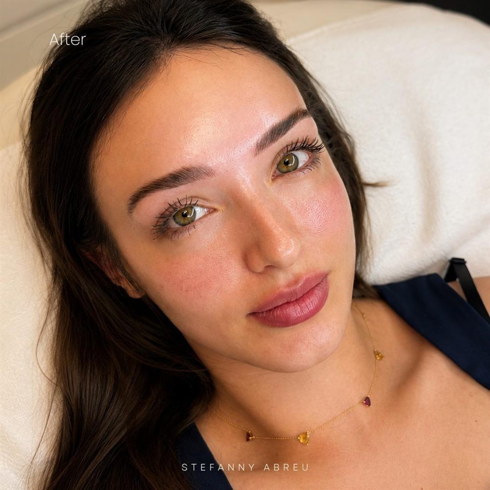 Full brow and lip result