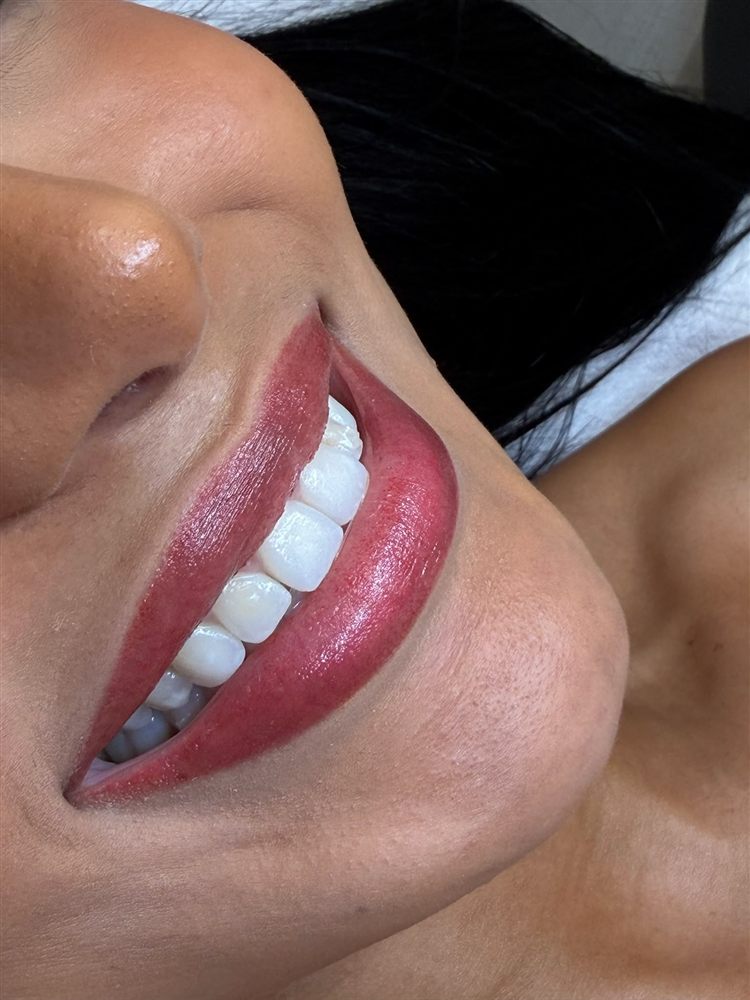 Lip blush result